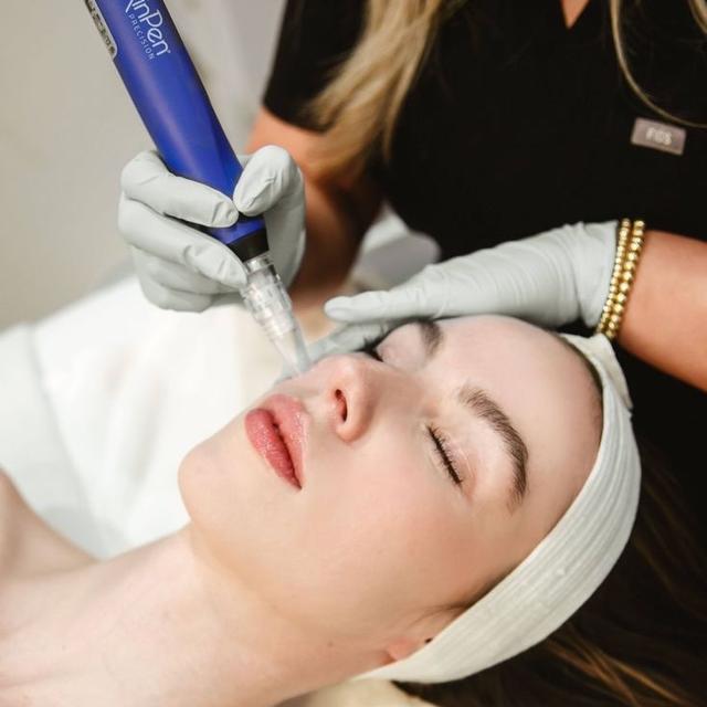 Microneedling W/ Skinpen